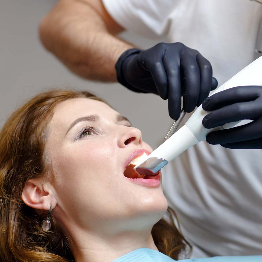 teeth-whitening-in-woodland-hills teeth-whitening-in-woodland-hills